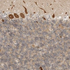 Immunohistochemical staining of human cerebellum shows strong cytoplasmic positivity in Purkinje cells.