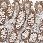 Immunohistochemical staining of human duodenum shows strong cytoplasmic positivity in glandular cells.