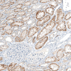 Immunohistochemical staining of human kidney shows granular cytoplasmic positivity in cells in tubules.