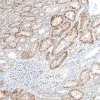 Immunohistochemical staining of human kidney shows granular cytoplasmic positivity in cells in tubules.