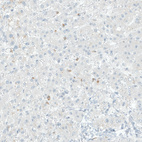 Immunohistochemical staining of human liver shows granular cytoplasmic positivity in hepatocytes.