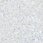 Immunohistochemical staining of human liver shows granular cytoplasmic positivity in hepatocytes.