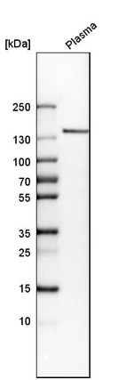 Western blot analysis in human plasma.