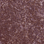 Immunohistochemical staining of human lymph node shows moderate nuclear positivity in non-germinal center cells.