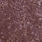 Immunohistochemical staining of human lymph node shows moderate nuclear positivity in non-germinal center cells.