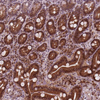 Anti-CDC14A Antibody
