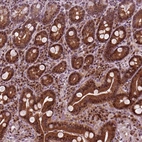 Immunohistochemical staining of human duodenum shows moderate nuclear positivity in glandular cells.