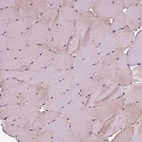 Immunohistochemical staining of human skeletal muscle shows very weak cytoplasmic positivity in myocytes.