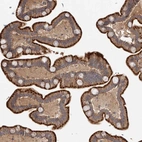 Immunohistochemical staining of human small intestine shows strong granular cytoplasmic positivity in glandular cells.