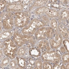 Immunohistochemical staining of human kidney shows moderate granular cytoplasmic positivity in cells in tubules.