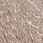Immunohistochemical staining of human heart muscle shows moderate granular cytoplasmic positivity in cardiomyocytes.