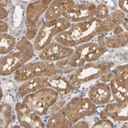 Anti-MSRA Antibody