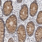 Immunohistochemical staining of human colon shows strong nuclear and cytoplasmic positivity in glandular cells.