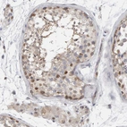 Immunohistochemical staining of human testis shows moderate nuclear and cytoplasmic positivity in cells in seminiferous ducts.