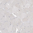 Immunohistochemical staining of human skeletal muscle shows no positivity in myocytes as expected.