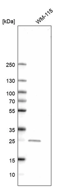 Western blot analysis in human cell line WM-115.