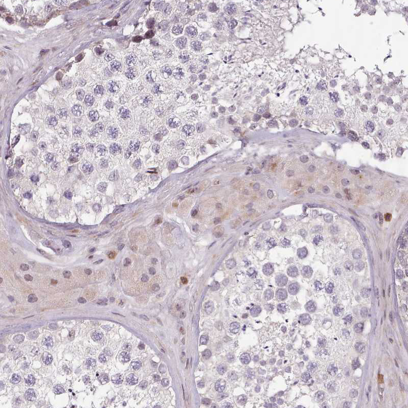 Anti-ZNF583 Antibody