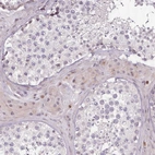 Anti-ZNF583 Antibody