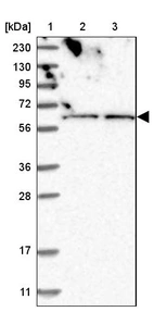 Lane 1: Marker [kDa] 230, 130, 95, 72, 56, 36, 28, 17, 11_br/_Lane 2: Human cell line RT-4_br/_Lane 3: Human cell line U-251MG sp