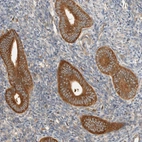 Immunohistochemical staining of human endometrium shows strong cytoplasmic positivity in glandular cells.