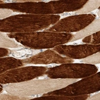 Immunohistochemical staining of human skeletal muscle shows strong cytoplasmic positivity in myocytes.