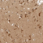 Immunohistochemical staining of human cerebral cortex shows strong cytoplasmic positivity in neurons.