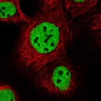 Immunofluorescent staining of human cell line A-431 shows localization to nucleoplasm.