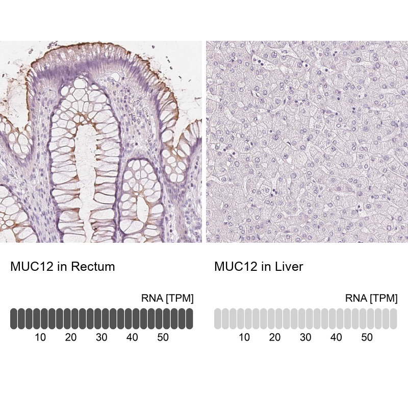 Anti-MUC12 Antibody