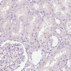 Immunohistochemical staining of human kidney shows no positivity in cells in tubules as expected.