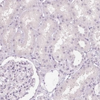 Immunohistochemical staining of human kidney shows no positivity in cells in tubules as expected.