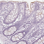 Immunohistochemical staining of human colon shows moderate positivity in glandular cells of apical membrane.