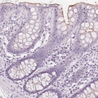 Immunohistochemical staining of human colon shows moderate positivity in glandular cells of apical membrane.