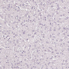 Anti-MUC12 Antibody