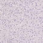 Immunohistochemical staining of human liver shows no positivity in hepatocytes as expected.