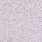 Immunohistochemical staining of human liver shows no positivity in hepatocytes as expected.