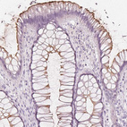 Immunohistochemical staining of human rectum shows moderate positivity in apical membrane in glandular cells.