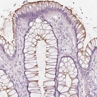 Immunohistochemical staining of human rectum shows moderate positivity in apical membrane in glandular cells.