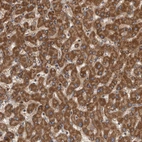 Anti-SDCBP Antibody