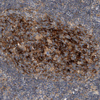 Immunohistochemical staining of human lymph node shows strong cytoplasmic positivity in germinal center cells.