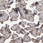 Immunohistochemical staining of human placenta shows weak tcytoplasmic positivity in trophoblastic cells.