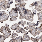 Immunohistochemical staining of human placenta shows weak tcytoplasmic positivity in trophoblastic cells.