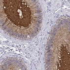 Anti-SPAG11B Antibody