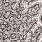 Immunohistochemical staining of human small intestine shows strong nuclear positivity in glandular cells.