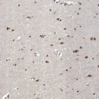 Immunohistochemical staining of human cerebral cortex shows strong nuclear positivity in neurons.