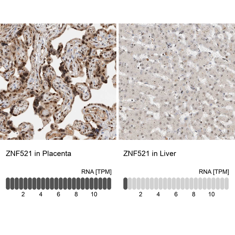 Anti-ZNF521 Antibody