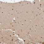 Immunohistochemical staining of human cerebellum shows strong nuclear positivity in cells in molecular layer.