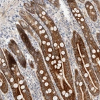 Immunohistochemical staining of human duodenum shows high expression.