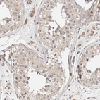 Immunohistochemical staining of human testis shows low expression as expected.