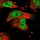 Immunofluorescent staining of human cell line U-251 MG shows localization to nucleoplasm.