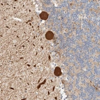 Immunohistochemical staining of human cerebellum shows strong cytoplasmic positivity in Purkinje cells.